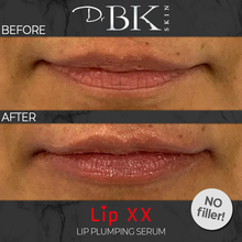 Load image into Gallery viewer, before-and-after-drbk-skin-lip-xx