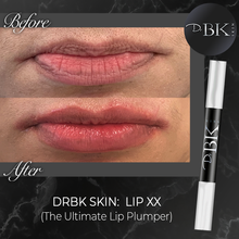 Load image into Gallery viewer, before-and-after-drbk-skin-lip-xx
