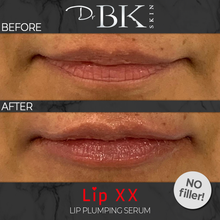 Load image into Gallery viewer, before-and-after-drbk-skin-lip-xx
